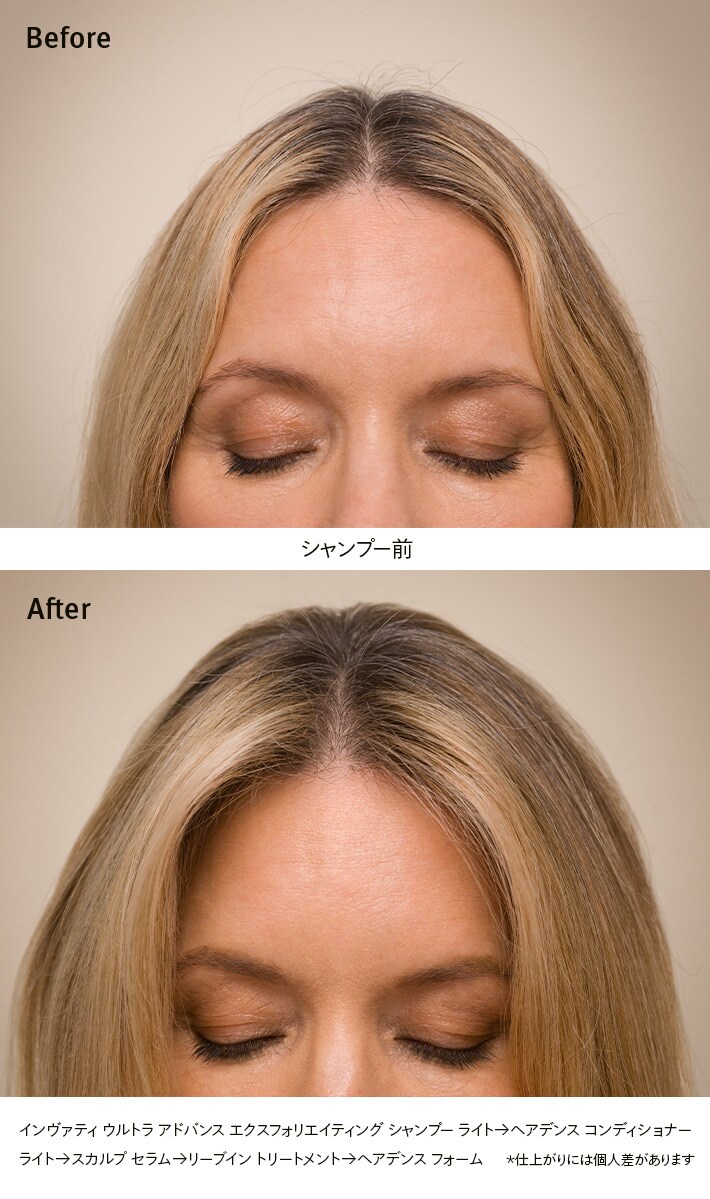 IUA revitalizing scalp serum Duo Set